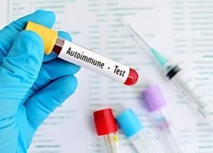 autoimmune test